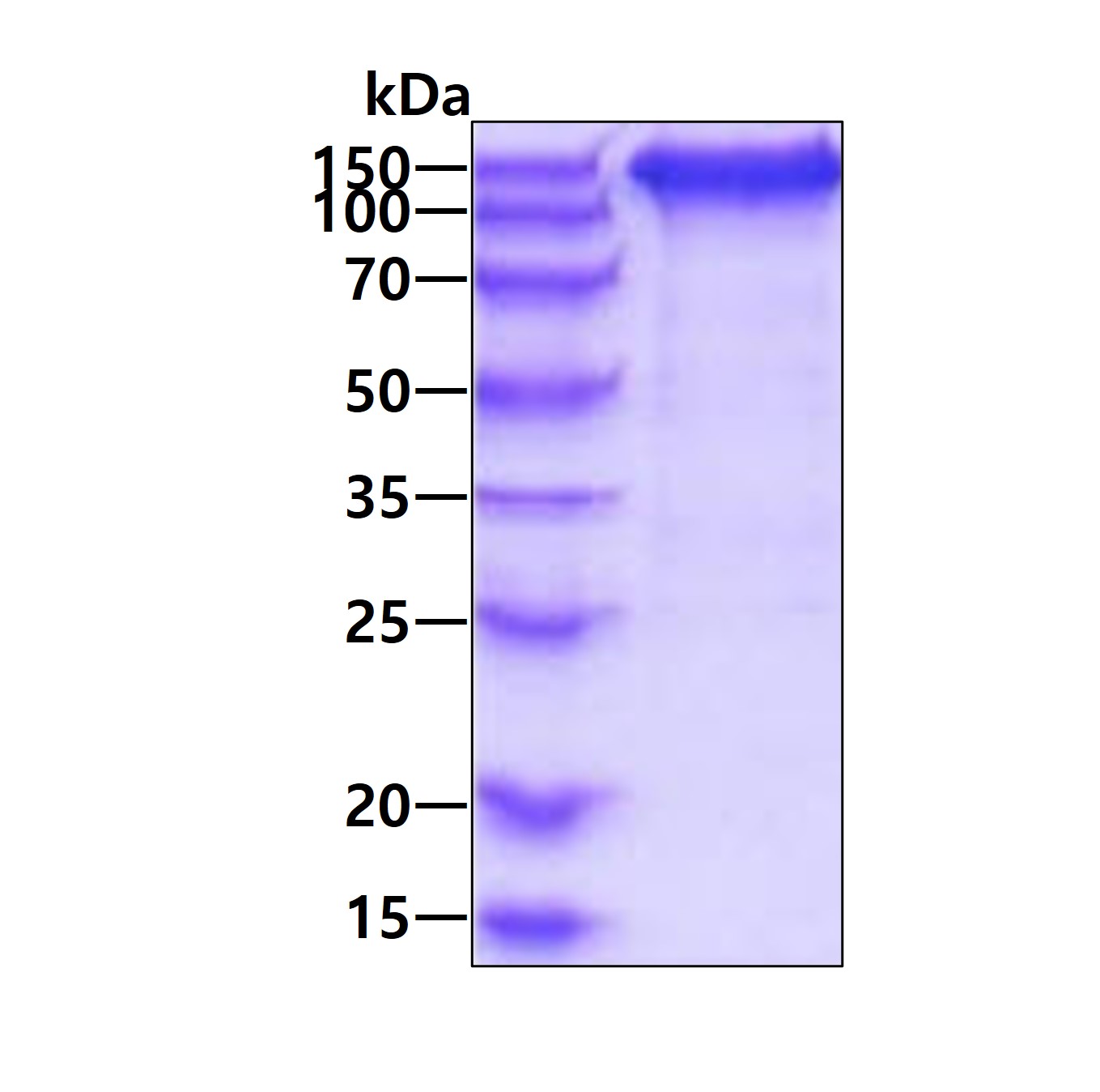 3 μg by SDS-PAGE under reducing condition and visualized by coomassie blue stain.